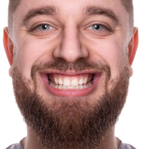 show tooth (1)